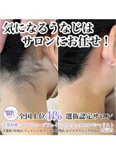 エリス(ELISSE)/うなじが脱毛が大人気