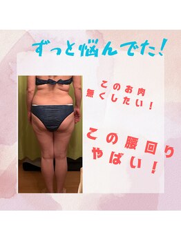 ヨサ パーク コアハート(YOSA PARK CORE HEART)/