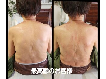 オアシス(OASIS)/ホット★カッサ