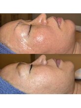 エミナル(EMINALu)/ハリや弾力は深部からケア