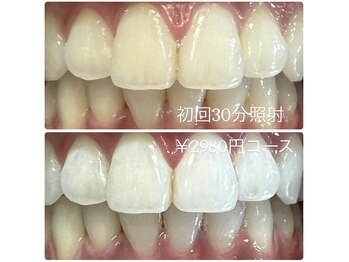 ホワイトニングルーム 横浜店(Whitening Room)/ホワイトニング/横浜