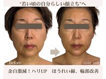 アンジェリカ(Angelica)/あの人年齢よりなんか若い！秘訣