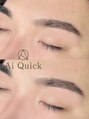 アイクイック 上石神井店(Ai Quick)&nbsp;ナチュラルアーチ×骨格補正