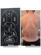 サロンドデュイ/1回施術/50 代/トーンヌール