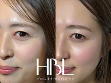 エクラ(Eclat)/HBL/ハリウッドブロウリフト