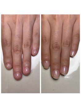 リヒネイル(Rihi.nail)/自爪育成