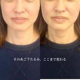 レディースカイロプラクティックカーム(calm)