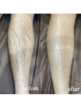 ユウユウ(YUYU)/ひざ下:男性　WAX＋LED