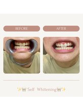 サロンエピ(Salon Epi)/セルフホワイトニング/烏丸御池