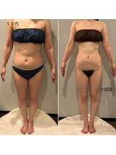 ソウソウビューティー 五反田(Shou Shou Beauty)/ハイパーナイフEX＋シェイプ