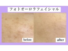 ルピナス ヒサヤ(LUPINUS hisaya)/フォトオーロラフラクショナル