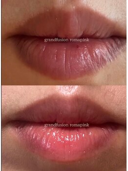 リュミエール デスポワール(Lumiere d'espoir)/ローマピンク