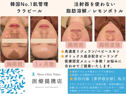 ミーカラー(mecalla.)の写真