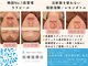 ミーカラー(mecalla.)の写真