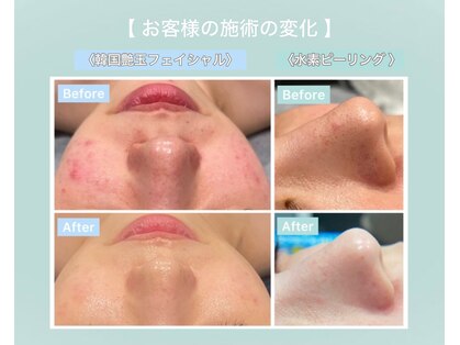 アンドミルル(and Milulu)の写真