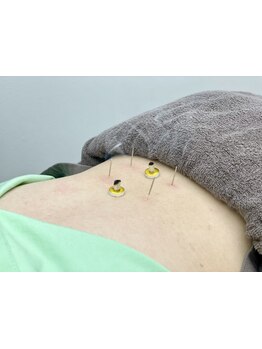 鍼灸施術を受けたい