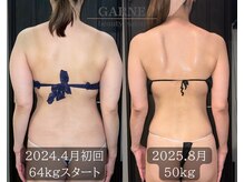 ガーネ 堺店(GARNE)/痩身ビフォーアフター/50代