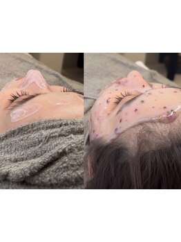 毛穴ケアをしたい