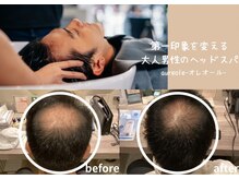 オレオール(aureole)