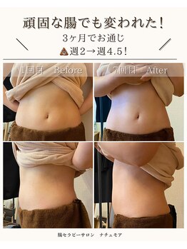ナチュモア(natyumoi)/カチカチお腹もやわらかく◎