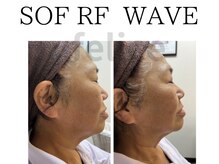 アイリー(IRIE)/ソフアールエフウェーブ