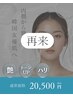 再来【内側から輝く水光肌に】ダウンタイムなしで韓国女優肌へ
