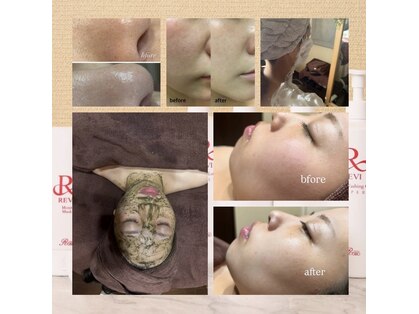 プレシャス(Precious)の写真