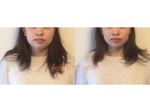 整体いったんとこ/小顔矯正