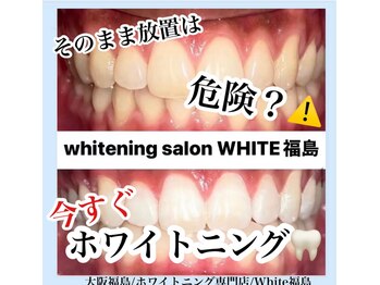 ホワイトニングサロン ホワイト(WHITE)/セルフホワイトニング/大阪/福島