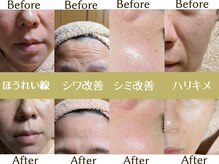 ラーナ(Lana)の雰囲気（年齢肌に関するお悩みはお任せ下さい☆たるみ改善/しみ改善/毛穴）