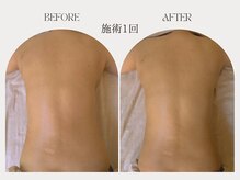 ネムリ(nemuri)の雰囲気（一度でも驚きの効果を実感、本格的なボディケアと美容を同時に。）