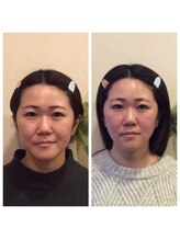 健幸堂 本店/小顔矯正1回→6回