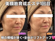 リエル(RIEL)/【美顔筋育成】