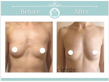 美人バスト 岡山店/バストアップ・バストケア症例★