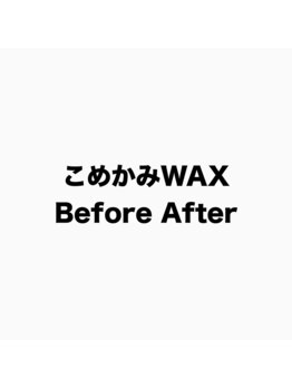 リジュベ(Rejuve)/こめかみWAX／オプション[眉毛]