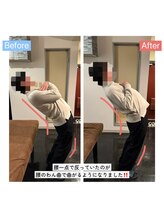整体サロン　アンティオール　大森本店【頭痛/不眠/耳鳴り/腰痛/肩こり/骨盤矯正】/Before→After【腰のお悩み】