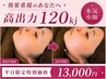 【先着4名限定★120kj】横顔をすっきり！高出力オンダリフト(全顔,顎下,首元)
