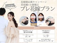 ハリカ 福岡天神店(HARIKA)の雰囲気（ブライダル支持率No.1。人生最高の小顔を引き出す美容鍼サロン◎）