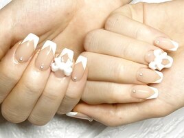 Vラインフレンチ