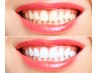 【再来◎歯のセルフホワイトニング】美しい歯で誰もが羨む笑顔に♪男女OK！
