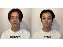 小顔堂 大阪心斎橋店/男前小顔コルギのできあがり☆