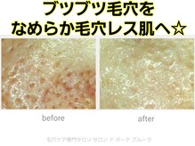 サロン ド ボーテ プルーラ(Salon de beaute PLURA)