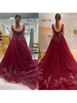 リリィ(lily)/7ヶ月ブライダルトリートメント