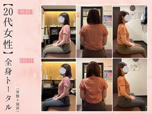 サクラ(SAKURA)/【20代後半】Before After