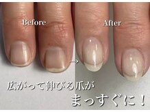 リリー/広がる爪がまっすぐに！