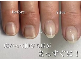 広がる爪がまっすぐに！