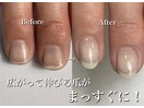 広がる爪がまっすぐに！