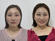 ウル 新宿代々木店(ULU)/クリアなカラーでパーツはっきり