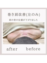 アリサナ(Arisana)/巻肩改善　首肩腰&バストケア