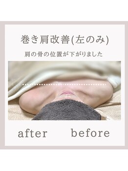 アリサナ(Arisana)/巻肩改善　首肩腰&バストケア